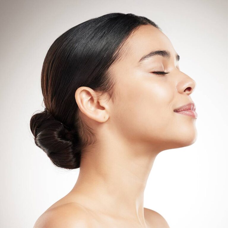 Seasonal Acne Flare-Ups